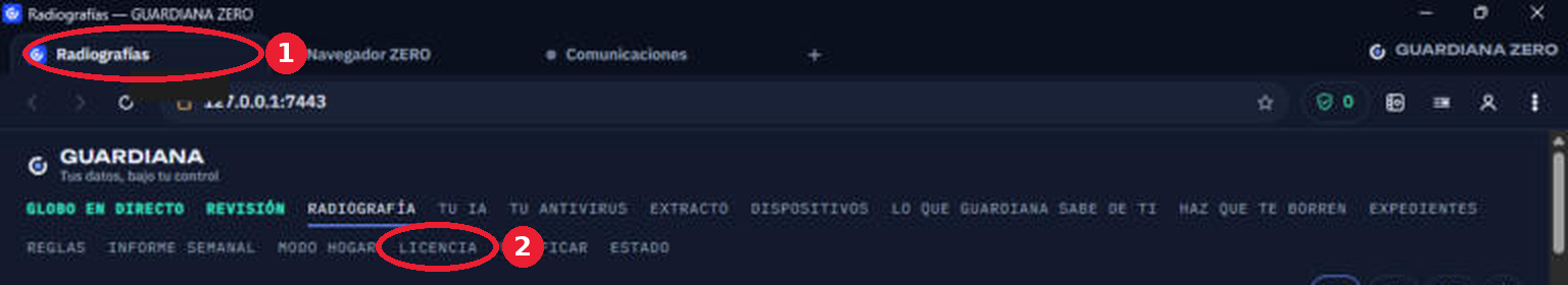 GUARDIANA ZERO: the X-rays tab marked 1 and the Licence menu item marked 2 (screen in Spanish).